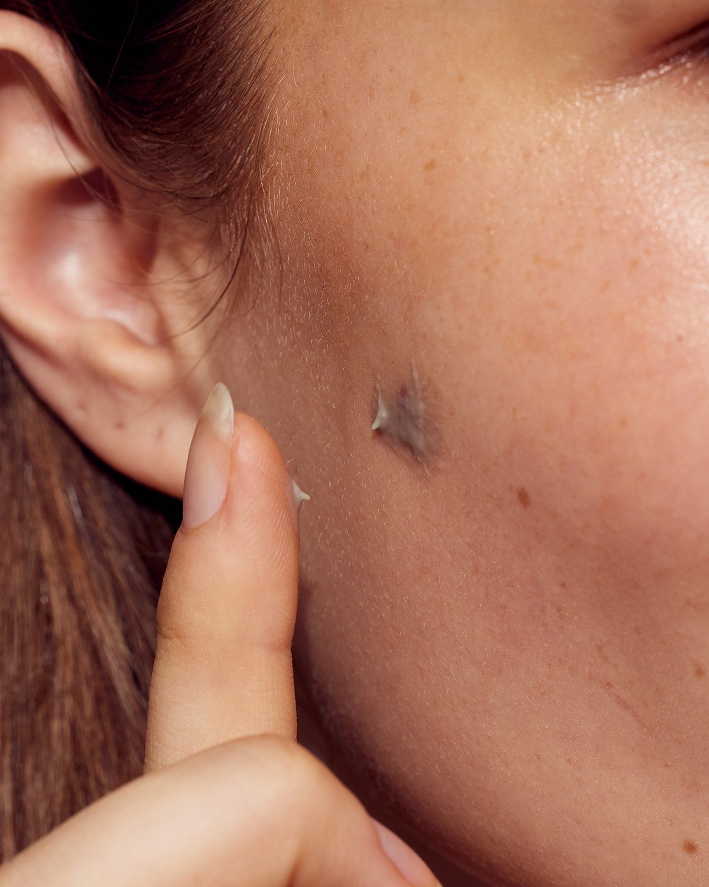 Reducerer rødme og behandler bumser effektivt.