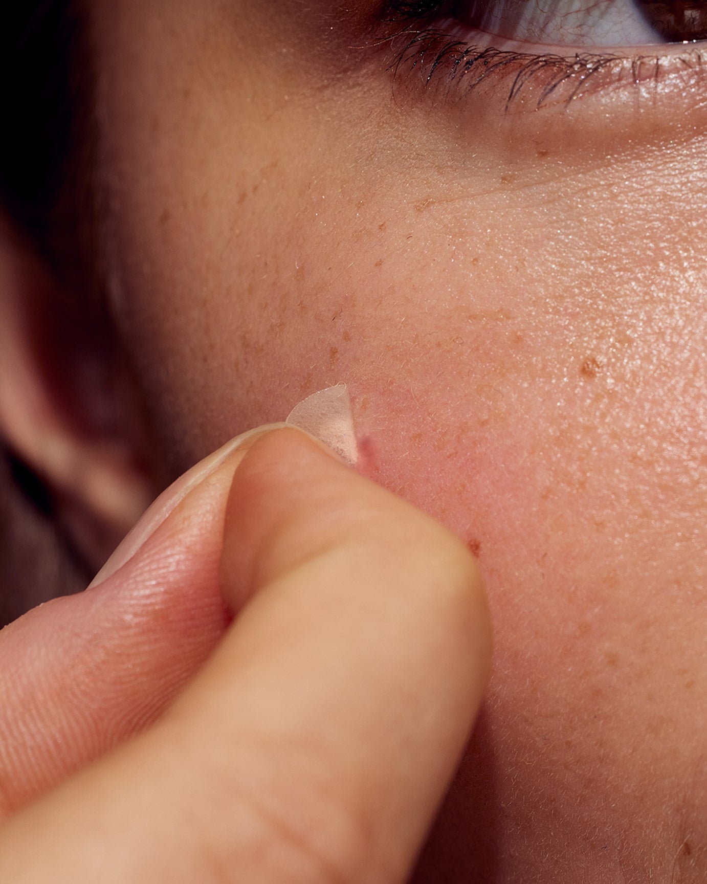 Absorberer bumser på kun 4-8 timer.